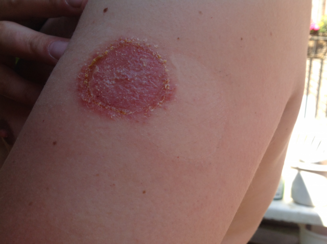 Libre-Ohne-alles - 1