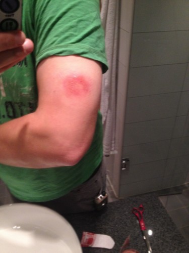 Ergebnis-Handschuhtest